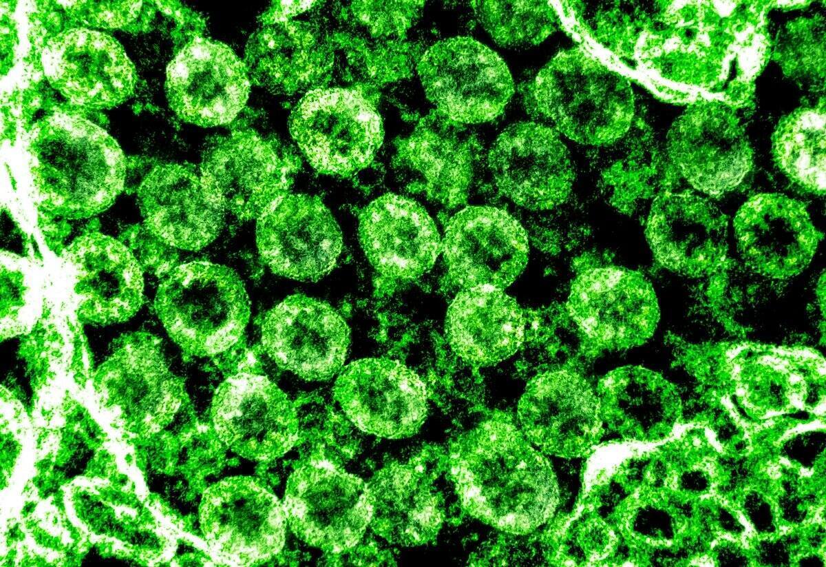 Fluoreszcens vírus