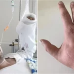 Macskaharapás belehalt egy dán férfi