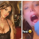 Török influenszer orvos tátott száj