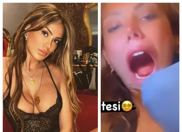 Török influenszer orvos tátott száj