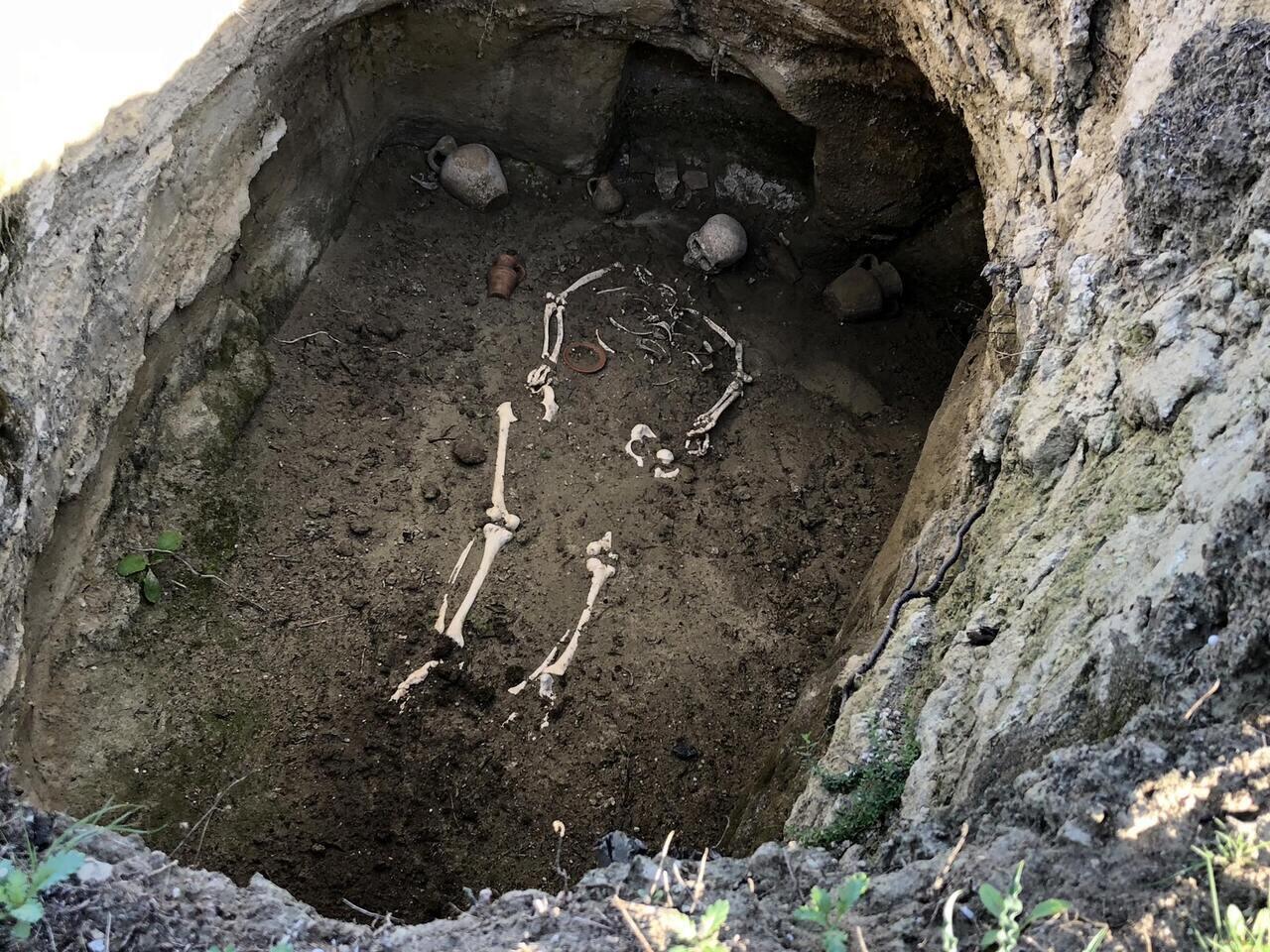 epilepszia nő szardínia ókor