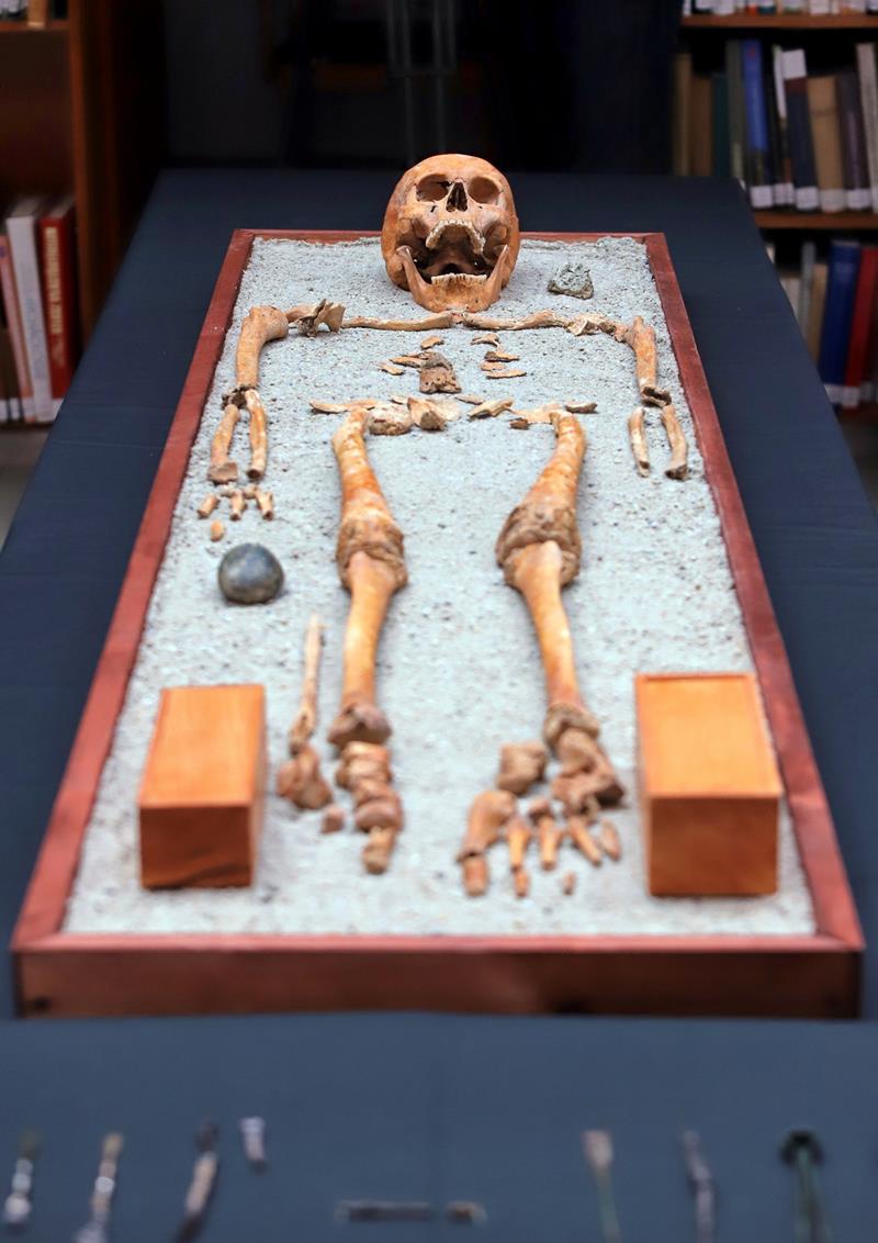 2000 éves orvos sírját tárták fel egyedülálló sebészeti eszközökkel a Jászságban - képek
