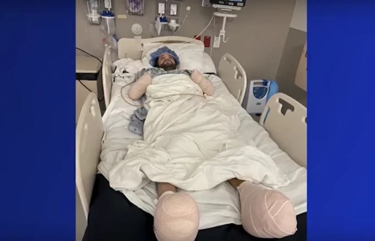 levágták a végtagjait ennek az amerikai férfinak