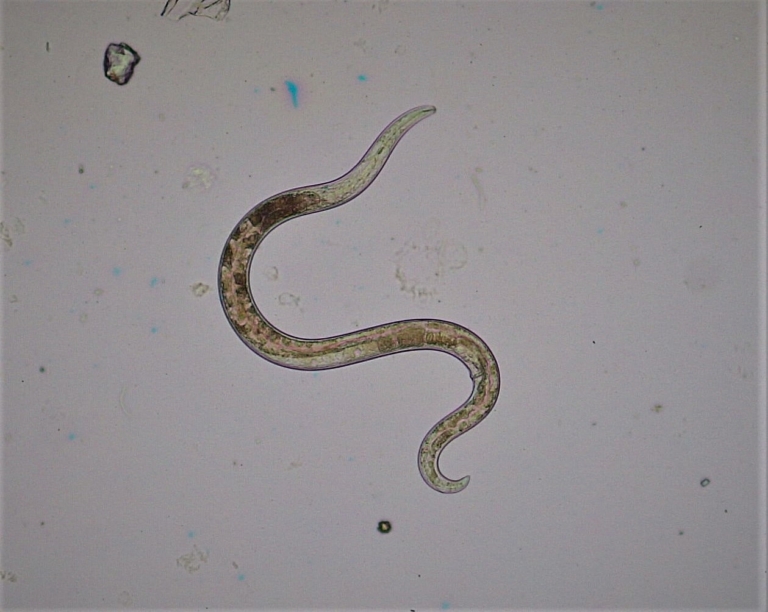 fonalféreg agy féreg