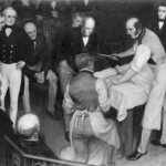 Robert Liston műtét