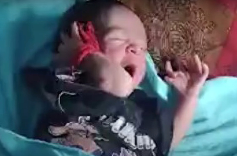 Istennőnek hiszik a sokujjú kislányt