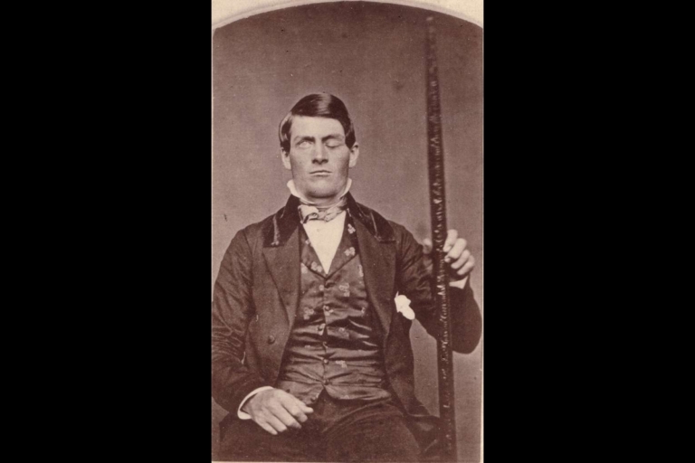 Phineas P. Gage