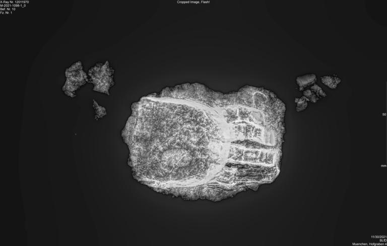 művégtag protézis csontváz