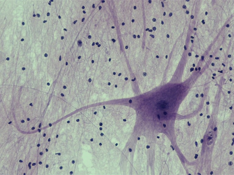 agyszövet mikroszkóp alatt agy