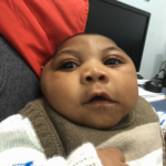 zika vírus rák