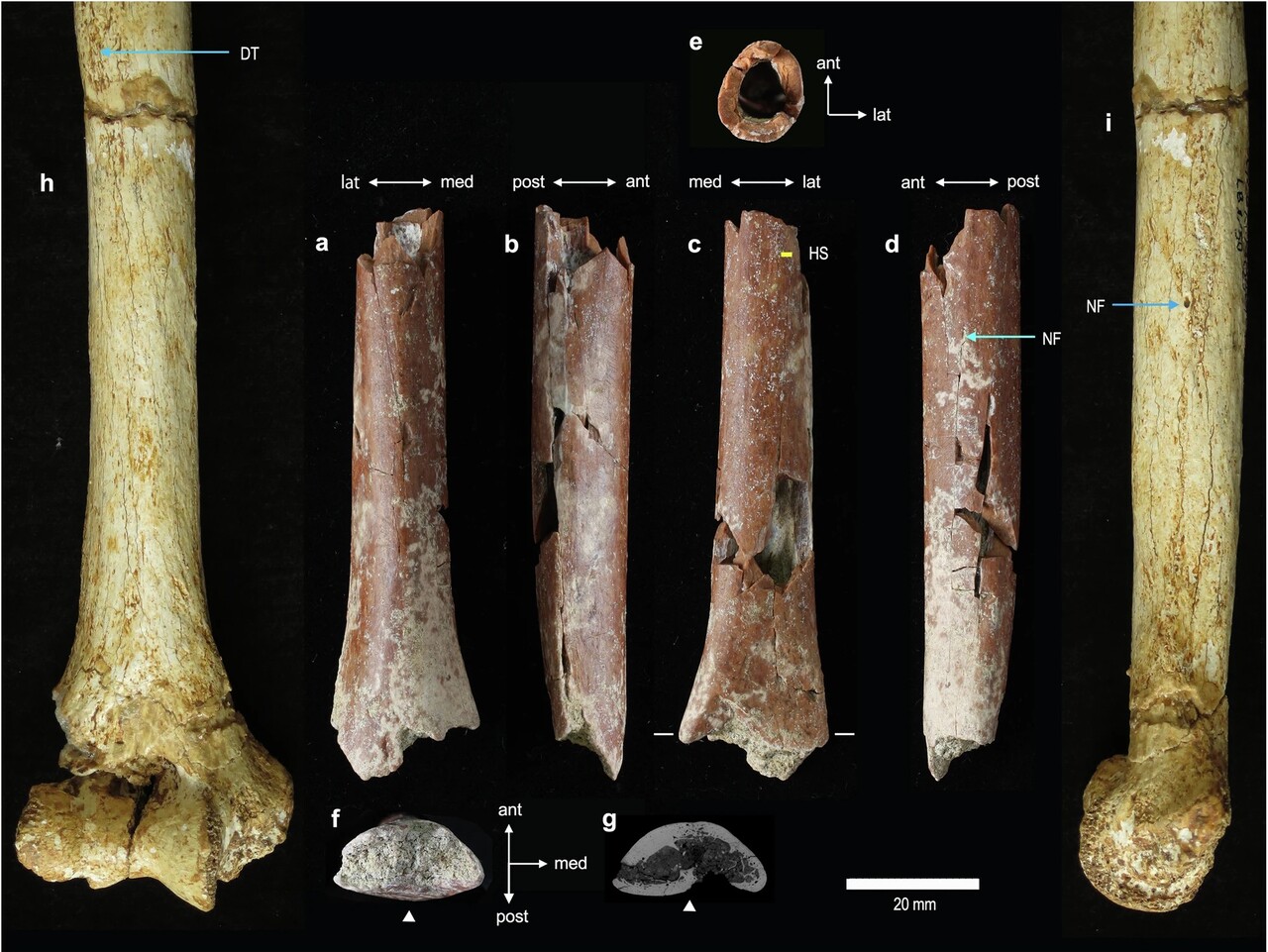 Homo floresiensis felkarcsont hobbit emberi faj