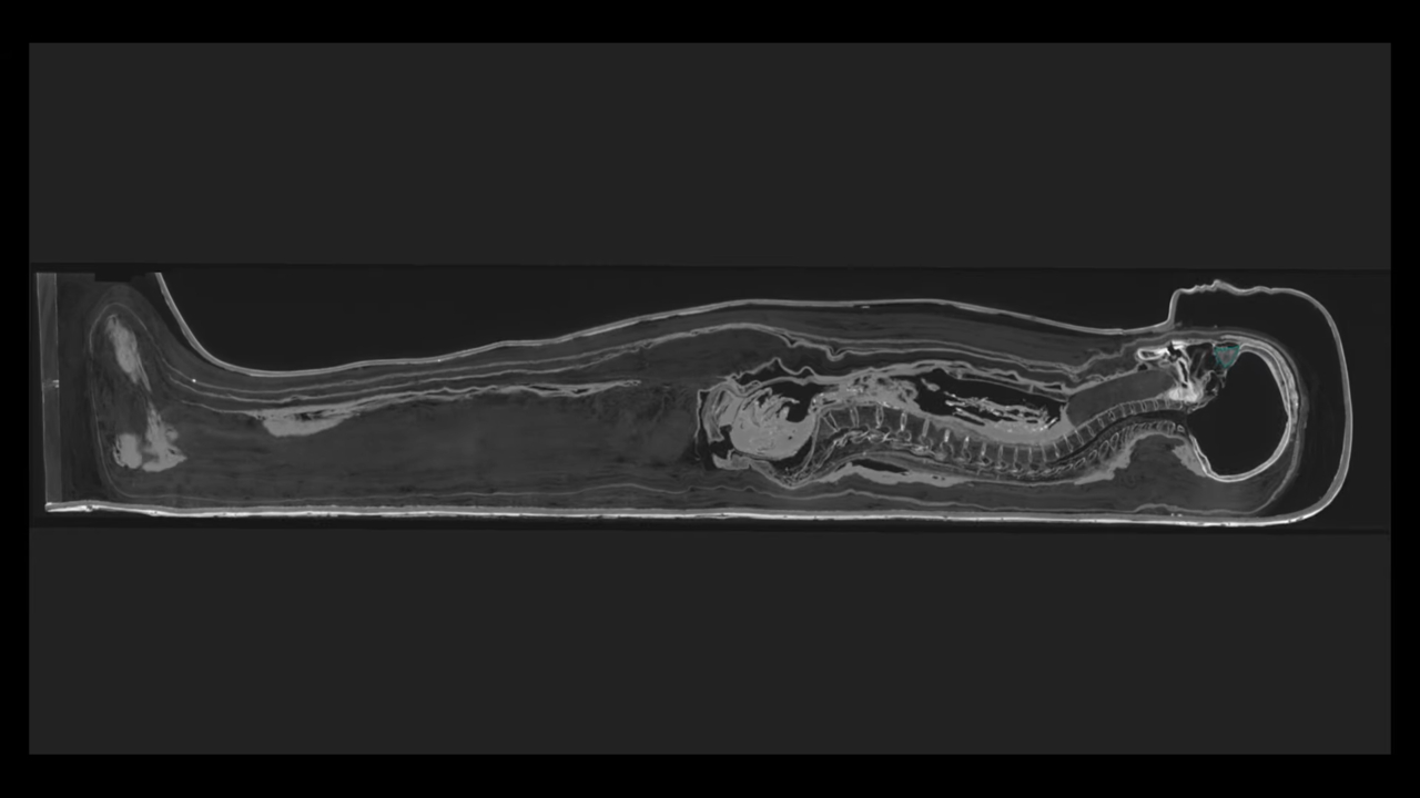egyiptomi múmia chenet-aa ct-vizsgálat szarkofág