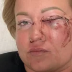 szentmartonkata-verekedes-noi-aldozat