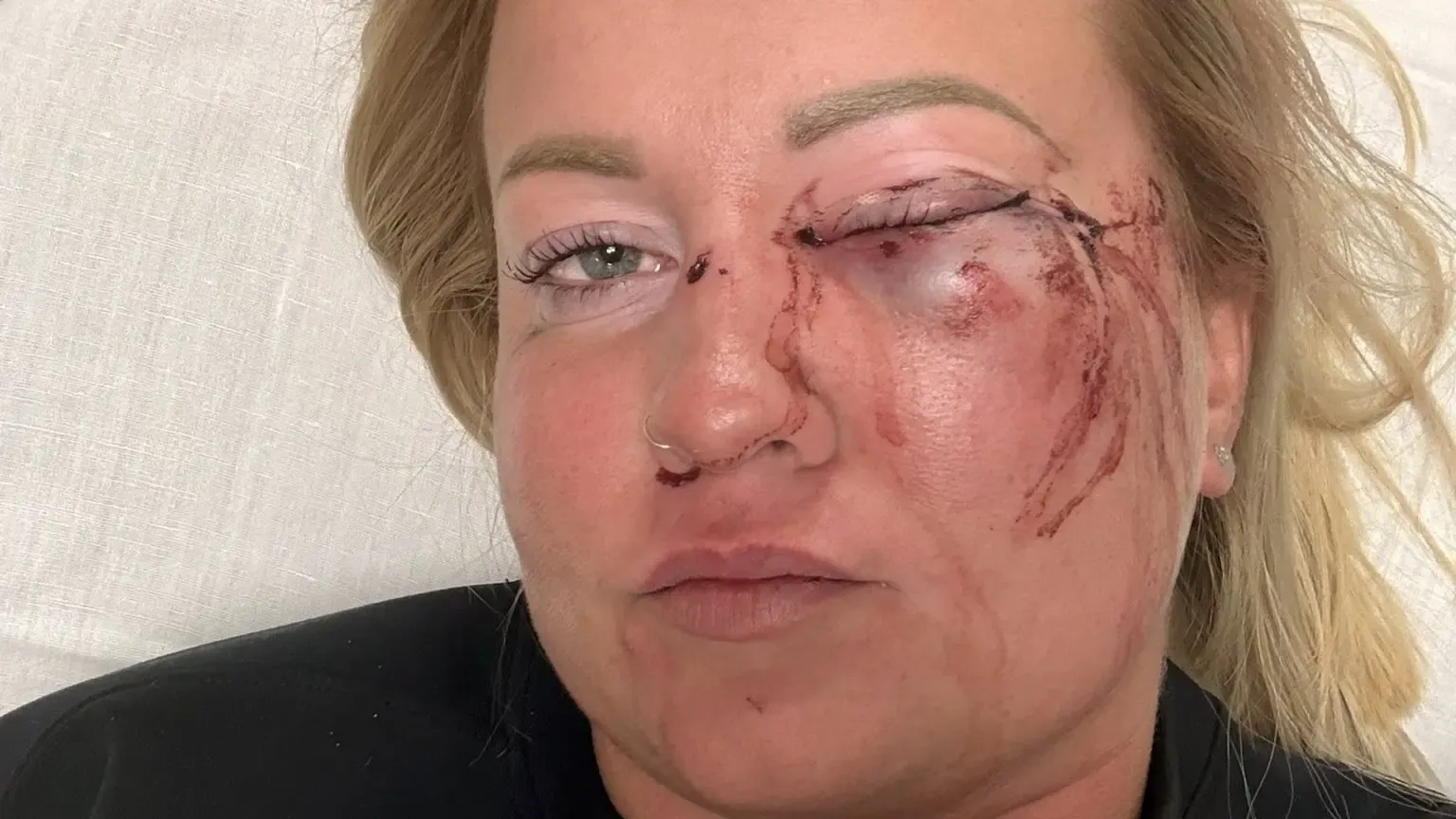 szentmartonkata-verekedes-noi-aldozat